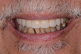 case-1_1_after