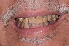 case-1_1_before