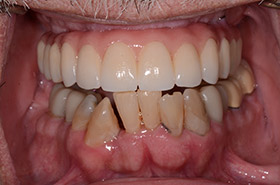 case-1_2_after