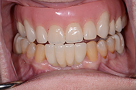 case-2_1_after