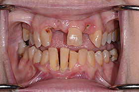 case-2_1_before