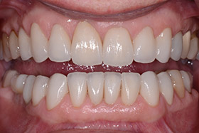 case-4_1_after