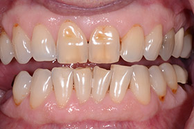 case-4_1_before