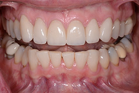 case-5_1_after
