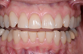 case-5_1_before