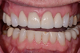 case-6_1_after