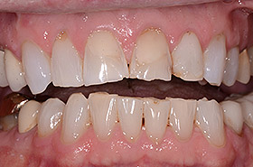 case-6_1_before