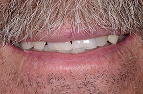 case-8_1_before