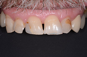 case-8_3_before