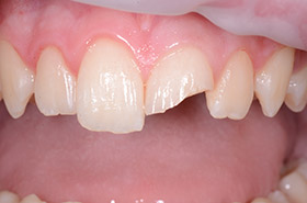 case-9_1_before