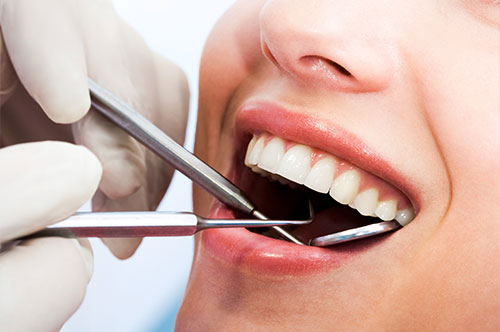 5 Simple Ways to Pay Less for Smile Care